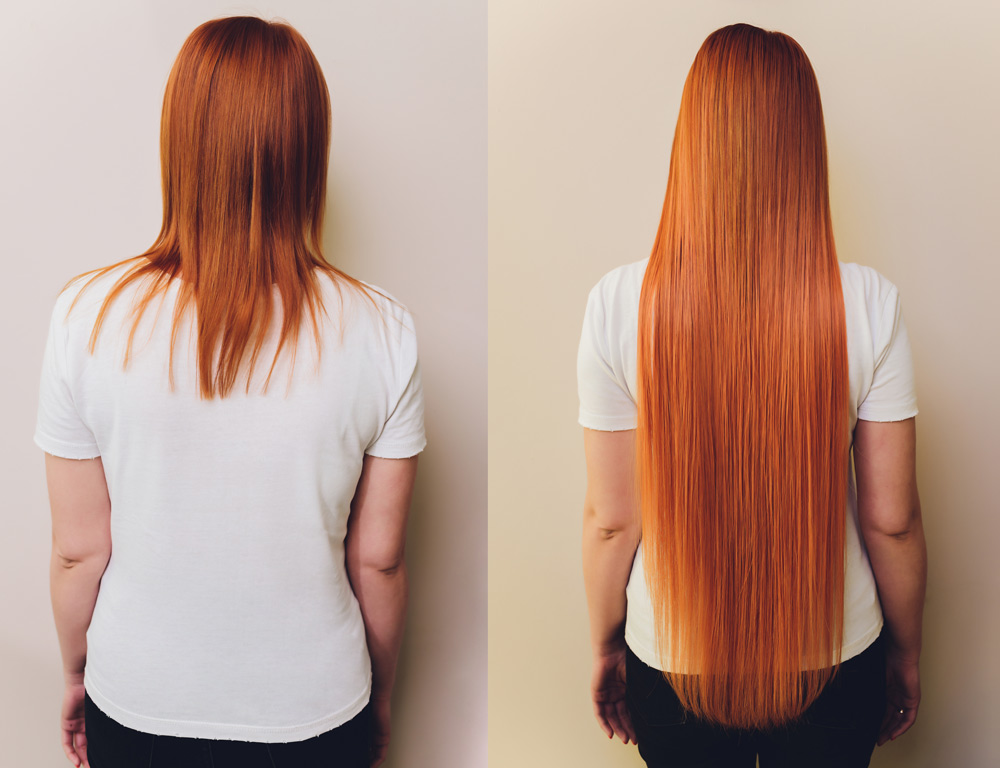 Hair Extensions in Romford | Nevi Hair and Aesthetics gallery image 5