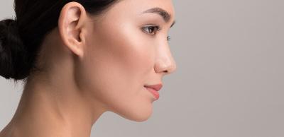 Woman with jawline filler